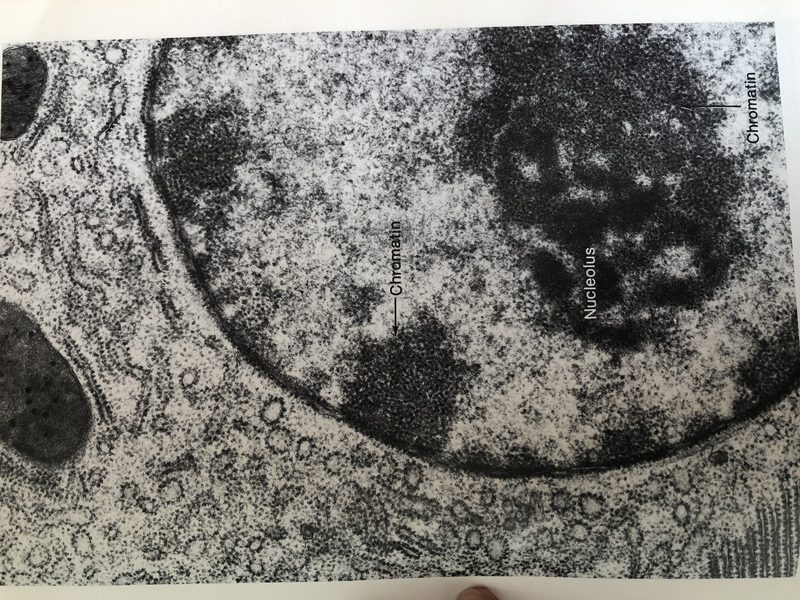 Electron micrograph of the nucleolus