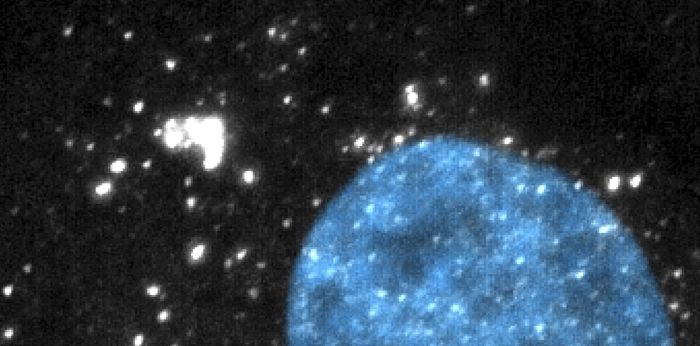 LINE-1 RNA imaging